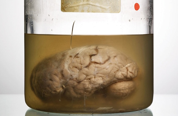 Это редчайшая коллекция фотографий человеческих мозгов, которую собрал фотограф Адам Вурхес Он выполнял редакционное задание научно-популярного журнала Scientific American и по долгу службы